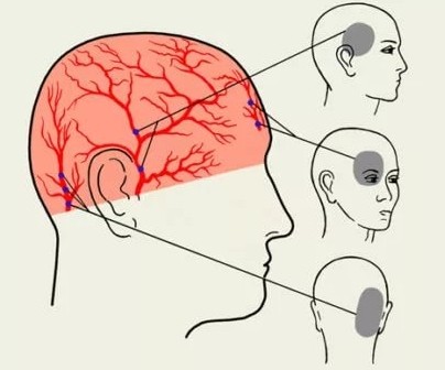 Болит голова в затылочной области и шее