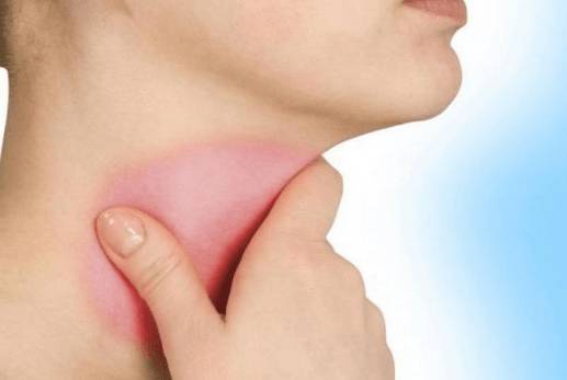 Болит горло тяжесть в голове