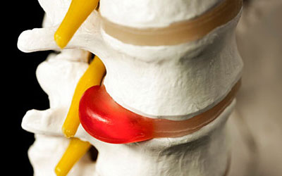 по ночам болит чуть ниже спины