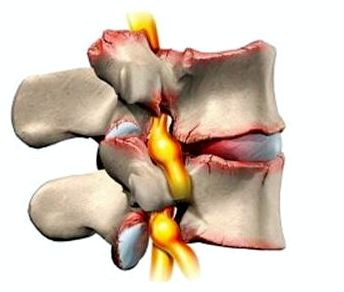 по ночам болит чуть ниже спины
