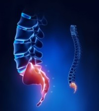 Болит спина в крестце как лечить