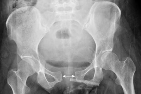 Как диагностировать патологические изменения фото Как диагностировать патологические изменения фото