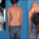 болит грудная клетка и боль отдает в спину